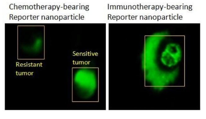 Una nanopartícula emite fluorescencia cuando las células tumorales mueren 