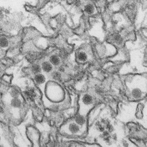 El Zika está relacionado con un trastorno autoinmune que ataca a la mielina