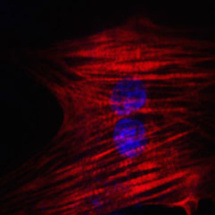 Transforman células de la piel en neuronas y células del corazón