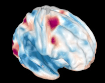 La corteza frontal del cerebro borra a veces cosas totalmente a la vista