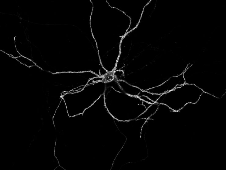 Un zoom sobre las neuronas descubre una cadena cerebral de luces