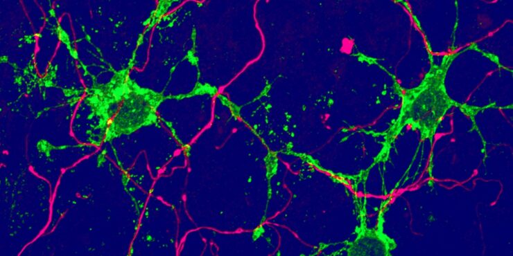 Nuevas células gliales podrían reparar el cerebro
